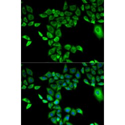 Dimethylaniline Monooxygenase [N-Oxide-Forming] 3 (FMO3) Antibody