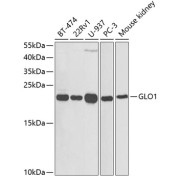 Western blot analysis of various lysates using GLO1 Antibody at 1/1000 dilution. Secondary antibody: HRP-conjugated Goat anti-Rabbit IgG (H+L) at 1/10000 dilution. Lysates/proteins: 25 µg per lane. Blocking buffer: 3% nonfat dry milk in TBST.