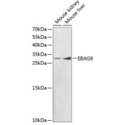 Western blot analysis of various lysates using EBAG9 Antibody at 1/1000 dilution. Secondary antibody: HRP-conjugated Goat anti-Rabbit IgG (H+L) at 1/10000 dilution. Lysates/proteins: 25 µg per lane. Blocking buffer: 3% nonfat dry milk in TBST.