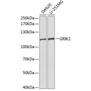 Western blot analysis of various lysates using GRIK2 Antibody at 1/1000 dilution. Secondary antibody: HRP-conjugated Goat anti-Rabbit IgG (H+L) at 1/10000 dilution. Lysates/proteins: 25 µg per lane. Blocking buffer: 3% nonfat dry milk in TBST.