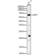 Western blot analysis of lysates from PC-3 cells, using NDP Antibody at 1/700 dilution. Secondary antibody: HRP-conjugated Goat anti-Rabbit IgG (H+L) at 1/10000 dilution. Lysates/proteins: 25 µg per lane. Blocking buffer: 3% nonfat dry milk in TBST. Exposure time: 180s.