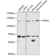 Western blot analysis of various lysates using PTPRA Antibody at 1/1000 dilution. Secondary antibody: HRP-conjugated Goat anti-Rabbit IgG (H+L) at 1/10000 dilution. Lysates/proteins: 25 µg per lane. Blocking buffer: 3% nonfat dry milk in TBST. Exposure time: 90s.