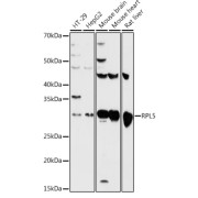 Western blot analysis of various lysates using RPL5 Antibody at 1/500 dilution. Secondary antibody: HRP-conjugated Goat anti-Rabbit IgG (H+L) at 1/10000 dilution. Lysates/proteins: 25 µg per lane. Blocking buffer: 3% nonfat dry milk in TBST. Exposure time: 60s.