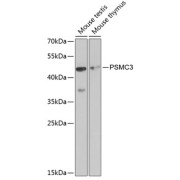 Western blot analysis of various lysates using PSMC3 Antibody at 1/1000 dilution. Secondary antibody: HRP-conjugated Goat anti-Rabbit IgG (H+L) at 1/10000 dilution. Lysates/proteins: 25 µg per lane. Blocking buffer: 3% nonfat dry milk in TBST.