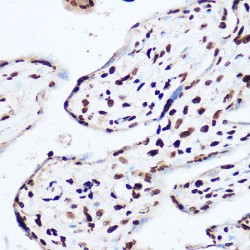 UDP-N-Acetylglucosamine--Peptide N-Acetylglucosaminyltransferase 110 kDa Subunit (OGT) Antibody