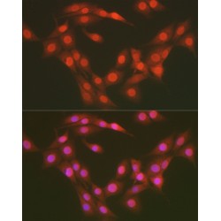 UDP-N-Acetylglucosamine--Peptide N-Acetylglucosaminyltransferase 110 kDa Subunit (OGT) Antibody