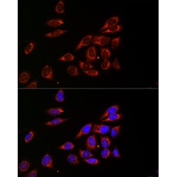 Cytidine Deaminase (CDA) Antibody