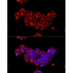 Cytidine Deaminase (CDA) Antibody