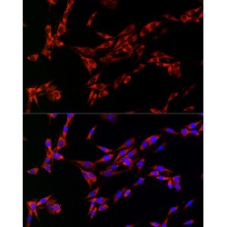 Cytidine Deaminase (CDA) Antibody