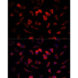 Insulin Like Growth Factor Binding Protein 4 (IGFBP4) Antibody