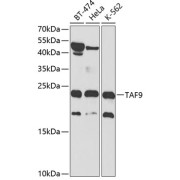 Western blot analysis of various lysates using TAF9 Antibody at 1/1000 dilution. Secondary antibody: HRP-conjugated Goat anti-Rabbit IgG (H+L) at 1/10000 dilution. Lysates/proteins: 25 µg per lane. Blocking buffer: 3% nonfat dry milk in TBST.