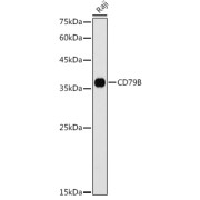 Western blot analysis of lysates from Raji cells, using CD79B Antibody at 1/1000 dilution. Secondary antibody: HRP-conjugated Goat anti-Rabbit IgG (H+L) at 1/10000 dilution. Lysates/proteins: 25 µg per lane. Blocking buffer: 3% nonfat dry milk in TBST. Exposure time: 180s.