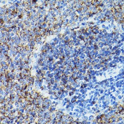 B-Cell Antigen Receptor Complex-Associated Protein Beta Chain (CD79B) Antibody