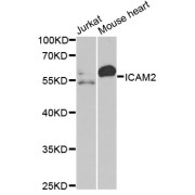 Western blot analysis of various lysates using ICAM2 Antibody at 1/1000 dilution. Secondary antibody: HRP-conjugated Goat anti-Rabbit IgG (H+L) at 1/10000 dilution. Lysates/proteins: 25 µg per lane. Blocking buffer: 3% nonfat dry milk in TBST.