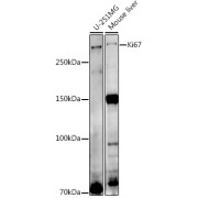 Western blot analysis of various lysates using Ki67 Antibody at 1/1000 dilution. Secondary antibody: HRP-conjugated Goat anti-Rabbit IgG (H+L) at 1/10000 dilution. Lysates/proteins: 25 µg per lane. Blocking buffer: 3% nonfat dry milk in TBST. Exposure time: 180s.