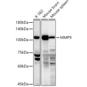 Western blot analysis of lysates from Mouse spleen using MMP9 Antibody at 1/1000 dilution. Secondary antibody: HRP-conjugated Goat anti-Rabbit IgG (H+L) at 1/10000 dilution. Lysates/proteins: 25 µg per lane. Blocking buffer: 3% nonfat dry milk in TBST. Exposure time: 30s.