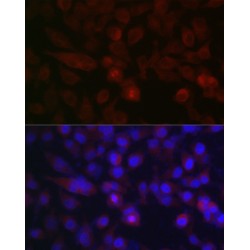 Aurora Kinase A (AURKA) Antibody