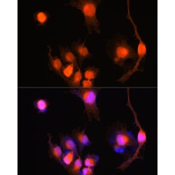 Ubiquitin Carboxyl Terminal Hydrolase L1 (UCHL1) Antibody