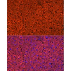 Cytochrome P450 2E1 (CYP2E1) Antibody