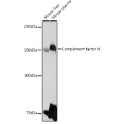 Western blot analysis of various lysates using Complement factor H Antibody at 1/1000 dilution. Secondary antibody: HRP-conjugated Goat anti-Rabbit IgG (H+L) at 1/10000 dilution. Lysates/proteins: 25 µg per lane. Blocking buffer: 3% nonfat dry milk in TBST. Exposure time: 10s.