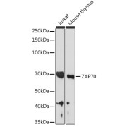 Western blot analysis of various lysates using ZAP70 Antibody at 1/1000 dilution. Secondary antibody: HRP-conjugated Goat anti-Rabbit IgG (H+L) at 1/10000 dilution. Lysates/proteins: 25 µg per lane. Blocking buffer: 3% nonfat dry milk in TBST. Exposure time: 180s.