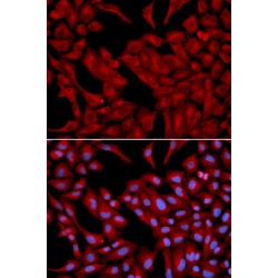 Dynactin Subunit 2 (DCTN2) Antibody