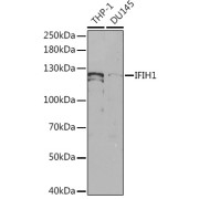 Western blot analysis of various lysates using IFIH1 Antibody at 1/1000 dilution. Secondary antibody: HRP-conjugated Goat anti-Rabbit IgG (H+L) at 1/10000 dilution. Lysates/proteins: 25 µg per lane. Blocking buffer: 3% nonfat dry milk in TBST.