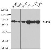 Western blot analysis of various lysates using NUP62 Antibody at 1/1000 dilution. Secondary antibody: HRP-conjugated Goat anti-Rabbit IgG (H+L) at 1/10000 dilution. Lysates/proteins: 25 µg per lane. Blocking buffer: 3% nonfat dry milk in TBST.