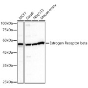 Western blot analysis of lysates from Daudi cells using Estrogen Receptor beta Antibody at 1/600 dilution. Secondary antibody: HRP-conjugated Goat anti-Rabbit IgG (H+L) at 1/10000 dilution. Lysates/proteins: 25 µg per lane. Blocking buffer: 3% nonfat dry milk in TBST. Exposure time: 10s.