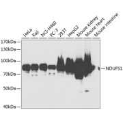 Western blot analysis of various lysates using NDUFS1 Antibody at 1/1000 dilution. Secondary antibody: HRP-conjugated Goat anti-Rabbit IgG (H+L) at 1/10000 dilution. Lysates/proteins: 25 µg per lane. Blocking buffer: 3% nonfat dry milk in TBST. Exposure time: 90s.