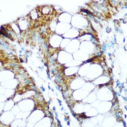 NADH Ubiquinone Oxidoreductase Core Subunit S1 (NDUFS1) Antibody