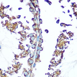 NADH Ubiquinone Oxidoreductase Core Subunit S1 (NDUFS1) Antibody