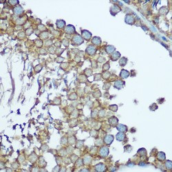 NADH Ubiquinone Oxidoreductase Core Subunit S1 (NDUFS1) Antibody