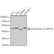 Western blot analysis of various lysates using Cytokeratin 15 (KRT15) Antibody at 1/400 dilution. Secondary antibody: HRP-conjugated Goat anti-Rabbit IgG (H+L) at 1/10000 dilution. Lysates/proteins: 25 µg per lane. Blocking buffer: 3% nonfat dry milk in TBST.