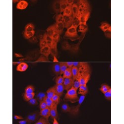 Keratin 15 (KRT15) Antibody