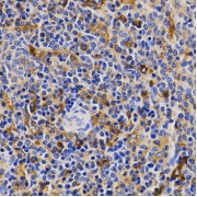 Immunohistochemistry analysis of paraffin-embedded Rat spleen using CDK20 Antibody at dilution of 1/200 (40x lens). Microwave antigen retrieval performed in 0.01 M PBS Buffer (pH 7.2) prior to IHC staining.