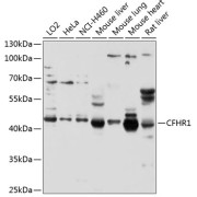 Western blot analysis of various lysates using CFHR1 Antibody at 1/1000 dilution. Secondary antibody: HRP-conjugated Goat anti-Rabbit IgG (H+L) at 1/10000 dilution. Lysates/proteins: 25 µg per lane. Blocking buffer: 3% nonfat dry milk in TBST. Exposure time: 30s.