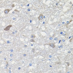 Cadherin Related 23 (CDH23) Antibody