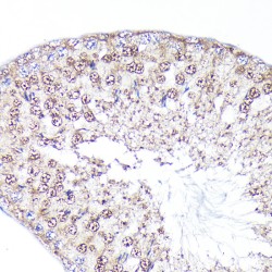 Retrotransposon-Derived Protein PEG10 (PEG10) Antibody