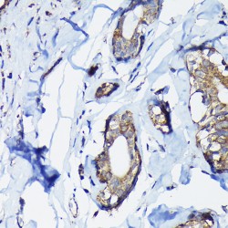 Retrotransposon-Derived Protein PEG10 (PEG10) Antibody