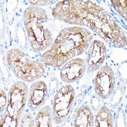 Retrotransposon-Derived Protein PEG10 (PEG10) Antibody