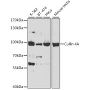 Western blot analysis of various lysates using Cullin 4A Antibody at 1/500 dilution. Secondary antibody: HRP-conjugated Goat anti-Rabbit IgG (H+L) at 1/10000 dilution. Lysates/proteins: 25 µg per lane. Blocking buffer: 3% nonfat dry milk in TBST. Exposure time: 5s.