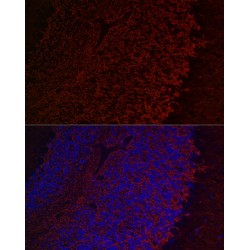 Aquaporin 4 (AQP4) Antibody