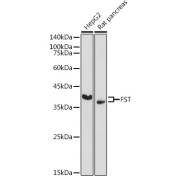 Western blot analysis of various lysates using FST Antibody at 1/500 dilution. Secondary antibody: HRP-conjugated Goat anti-Rabbit IgG (H+L) at 1/10000 dilution. Lysates/proteins: 25 µg per lane. Blocking buffer: 3% nonfat dry milk in TBST. Exposure time: 90s.