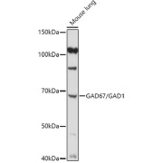 Western blot analysis of lysates from Mouse lung, using at 1/1000 dilution. Secondary antibody: HRP-conjugated Goat anti-Rabbit IgG (H+L) at 1/10000 dilution. Lysates/proteins: 25 µg per lane. Blocking buffer: 3% nonfat dry milk in TBST. Exposure time: 90s.