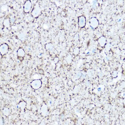 Glutamate Decarboxylase 1 (GAD1) Antibody