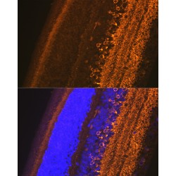 Glutamate Decarboxylase 1 (GAD1) Antibody