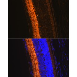 Glutamate Decarboxylase 1 (GAD1) Antibody