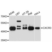 Western blot analysis of various lysates using CXCR3 Antibody at 1/3000 dilution. Secondary antibody: HRP-conjugated Goat anti-Rabbit IgG (H+L) at 1/10000 dilution. Lysates/proteins: 25 µg per lane. Blocking buffer: 3% nonfat dry milk in TBST. Exposure time: 90s.