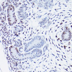 High Mobility Group Protein HMGI-C (HMGA2) Antibody